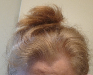 Orange hair after Nordic Blonde dye